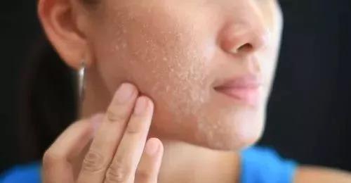 含胸低頭走路 隱藏的健康風(fēng)險(xiǎn)與缺氧眩暈的關(guān)聯(lián)